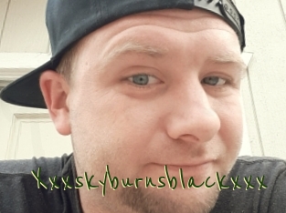 Xxxskyburnsblackxxx